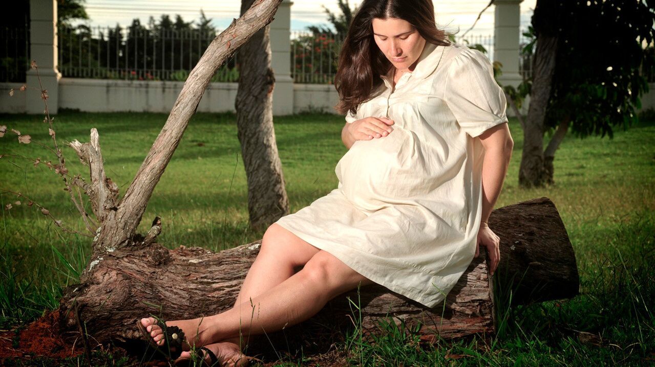 El embarazo es un factor en el desarrollo de varices en las piernas. 